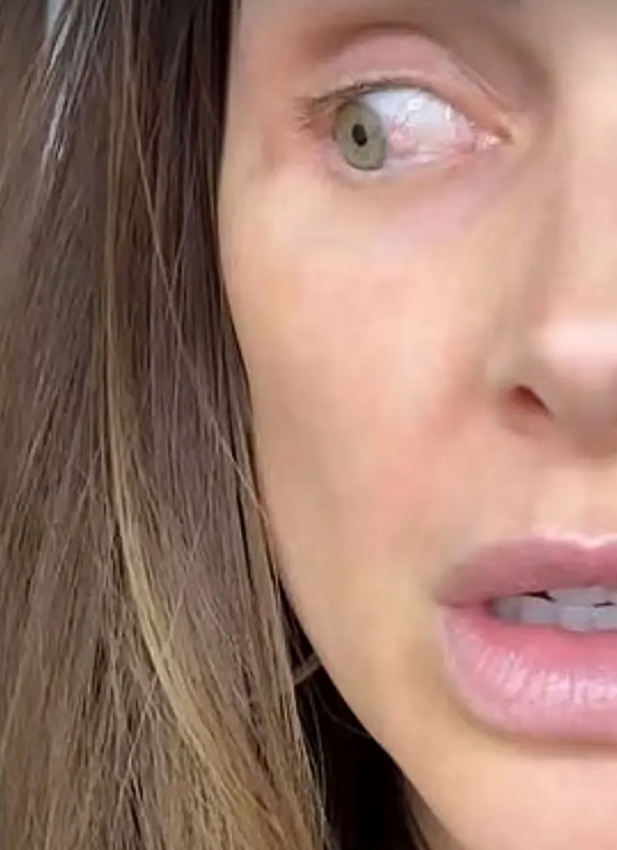 Lala Kent Says She's Taking Chemo Drops For Pre-Cancerous Growth On Her Eye! Oh No!