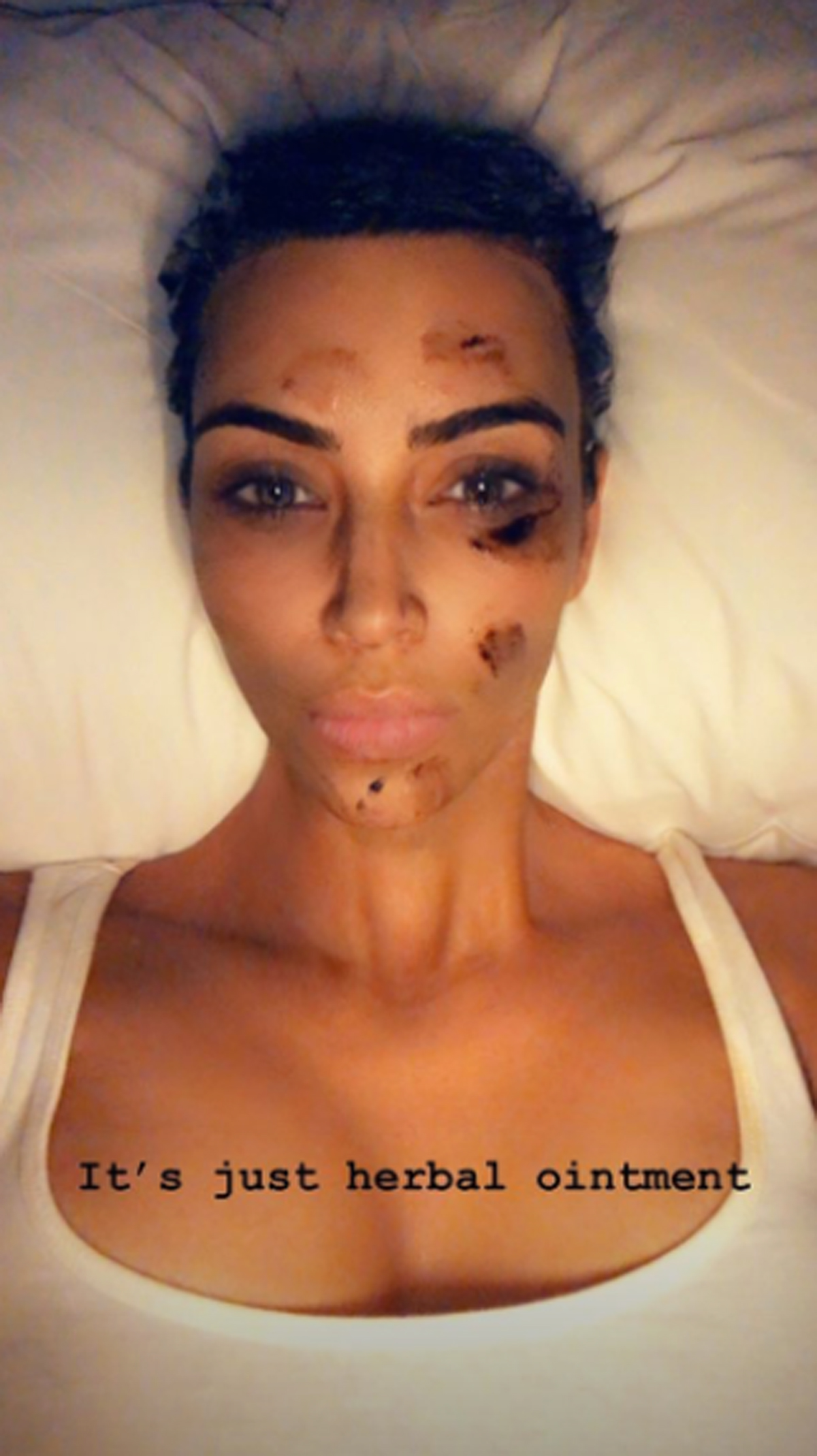 Kim Kardashian Conceals Her Psoriasis With Body Makeup! - Perez Hilton