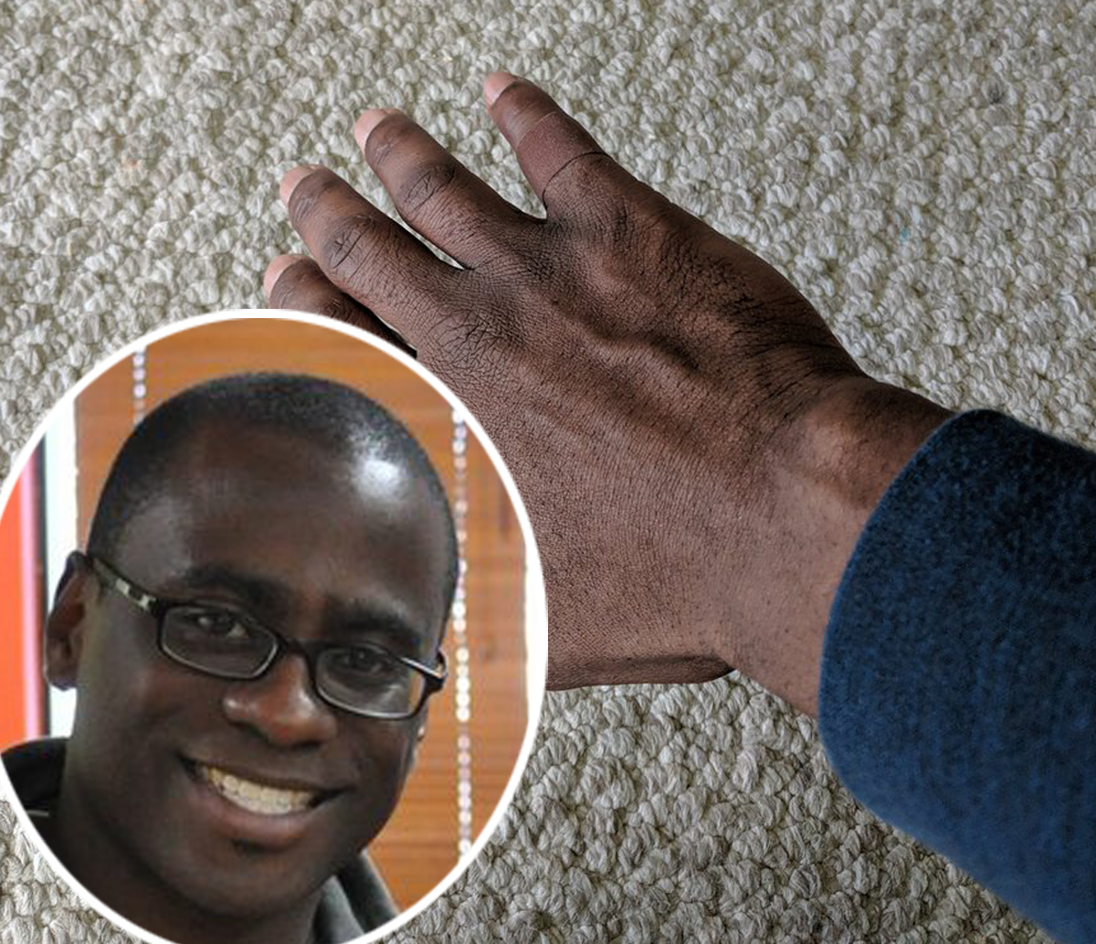 Man’s Emotional Experience Putting On A BandAid That Matches His Skin