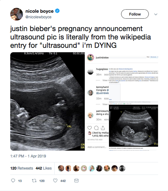 Is Justin Bieber going to be a dad??