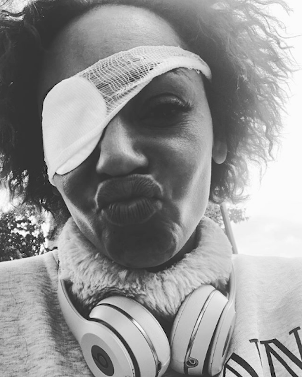 mel b rocks an eye patch