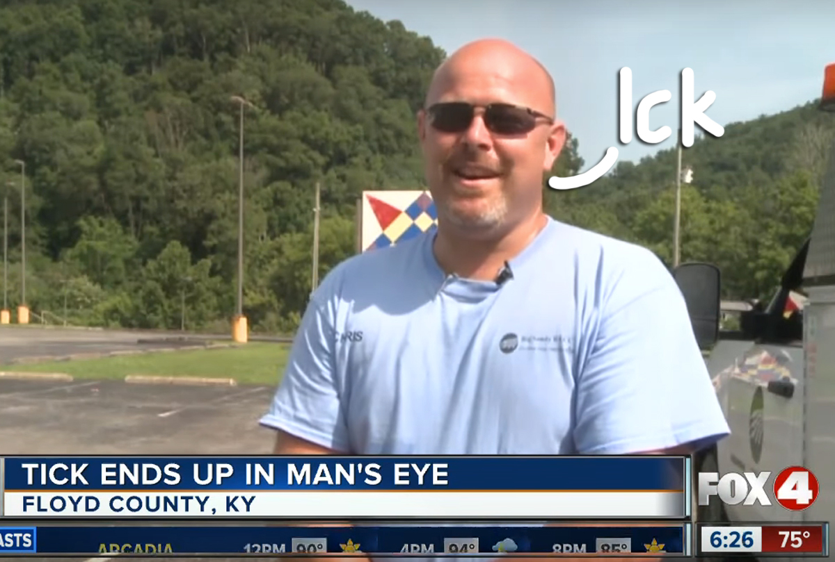 Man Suffering From Eye 'Irritation' Finds Out He Has A TICK STUCK IN
