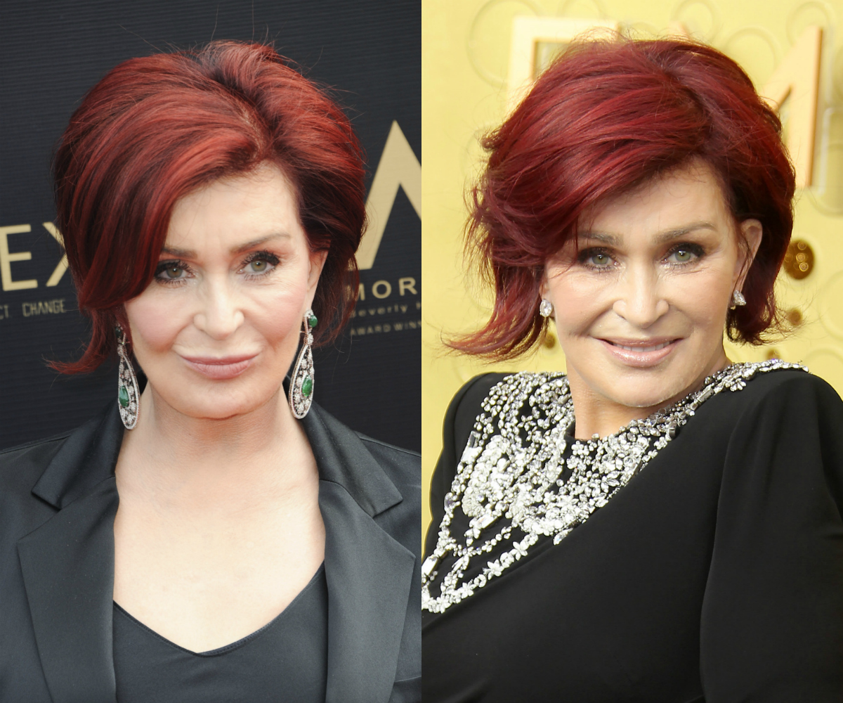 Sharon Osbourne Reveals She 'Can Hardly Feel' Her Mouth After Lat...
