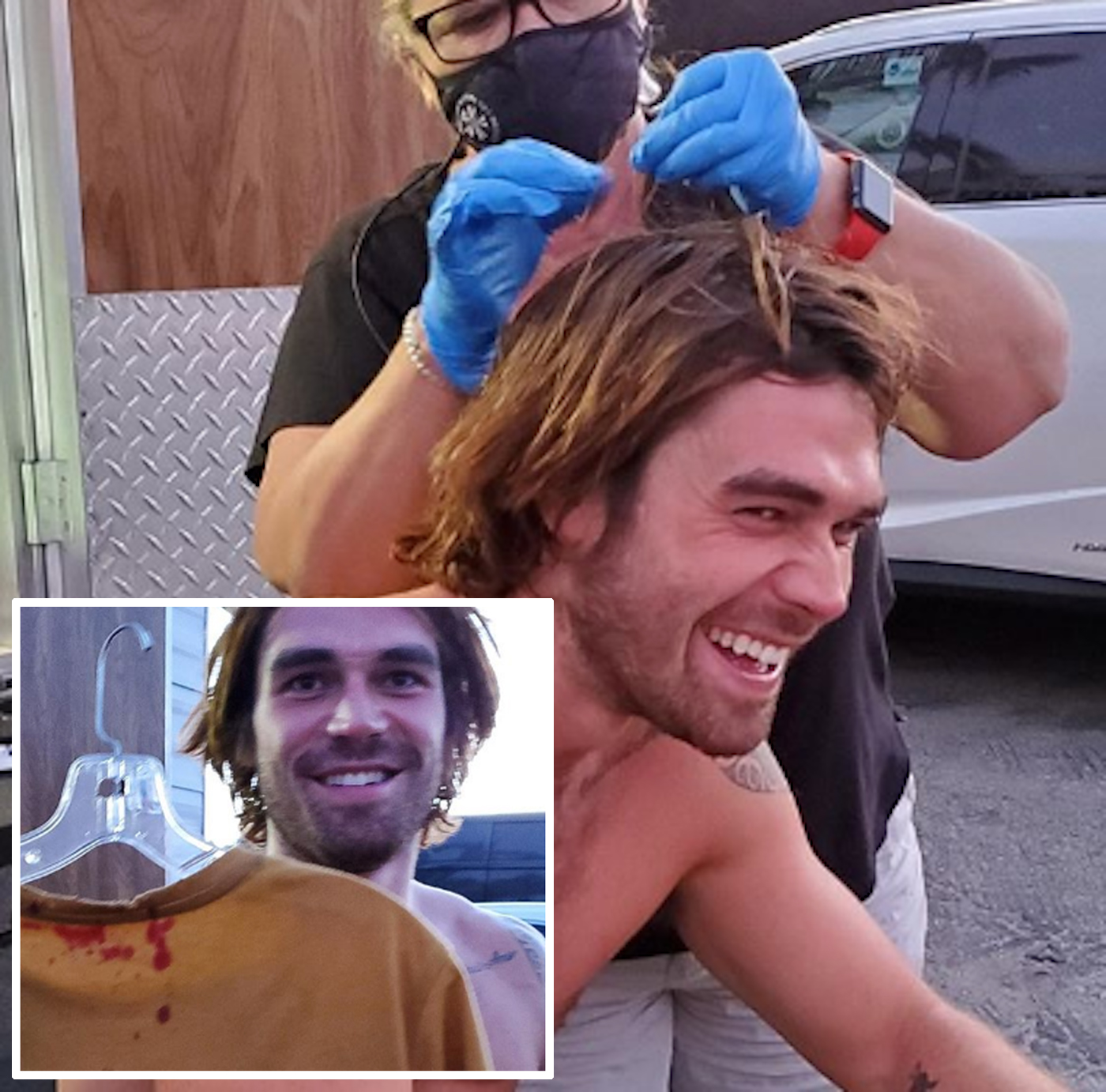 Kj Apa Split His Head Open While Filming New Movie — Ahhhhh Perez Hilton