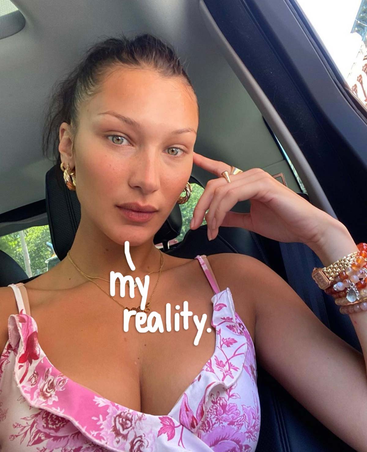 Bella Hadid Completes Over 100 Days Of Lyme Disease Treatment