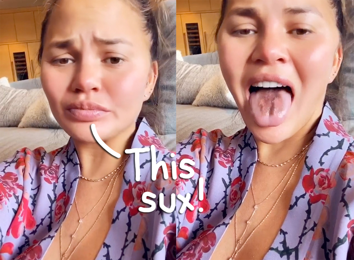 chrissy-teigen-has-been-eating-so-much-sour-candy-during-pregnancy-that