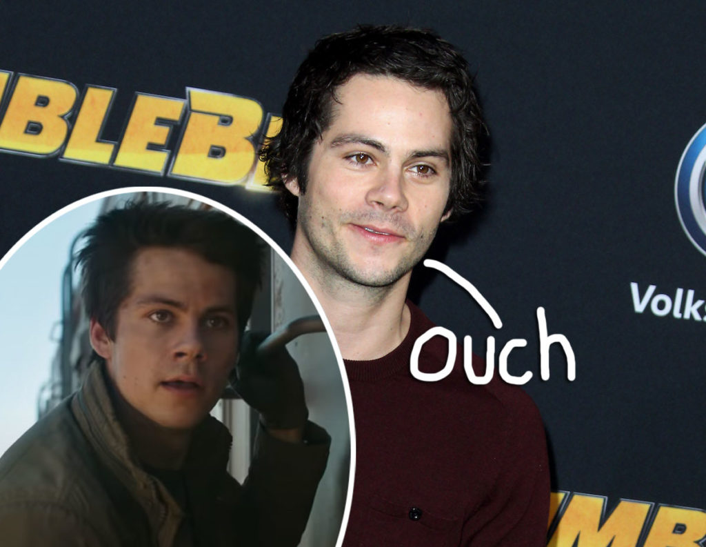 Dylan O'Brien Has 'Anxiety' After Maze Runner Set Injury