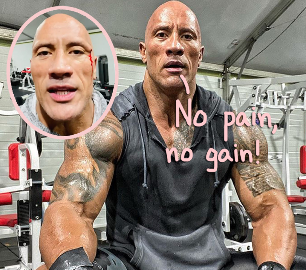 Agency News, Dwayne Johnson AKA The Rock Suffers Face Injury During  Workout (Watch Video)