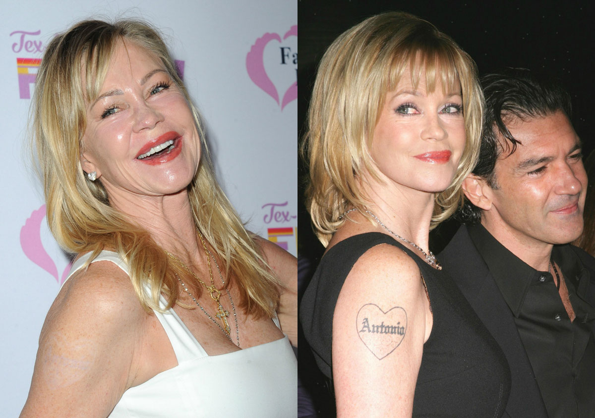 Melanie Griffith tattoo removal