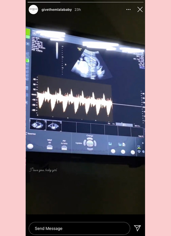 lala kent's sonogram via IG story