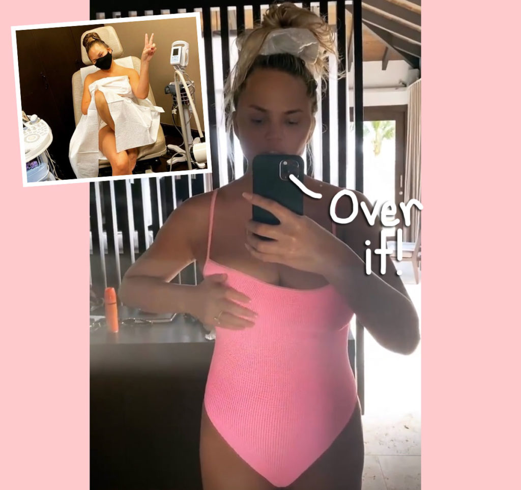 Chrissy Teigen has one breast larger than the other, Things To Do