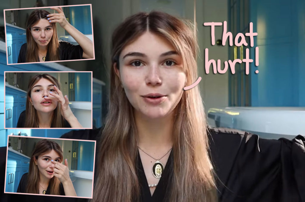 Omg Olivia Jade Split Her Lip And Chipped Her Tooth After Passing Out On 