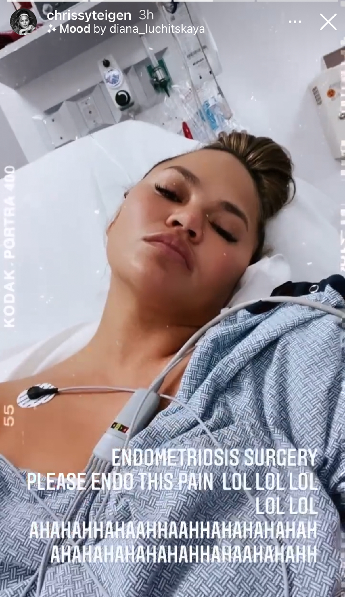 Chrissy Teigen Shares Hospital Selfies, Talks Heartbreaking ‘Phantom’ Baby Kicks