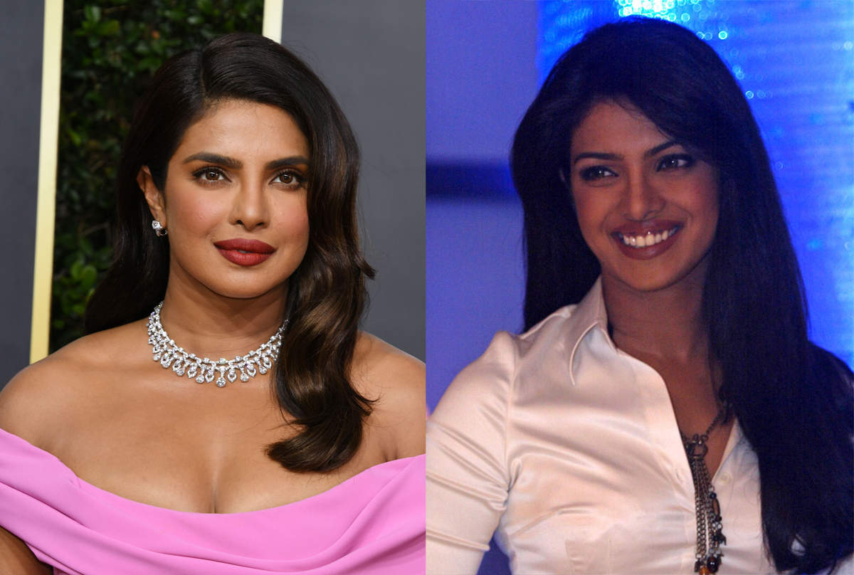 Priyanka Chopra Reveals Her Nose Is Actually The Result Of Botched Surgery En BuradaBiliyorum Com