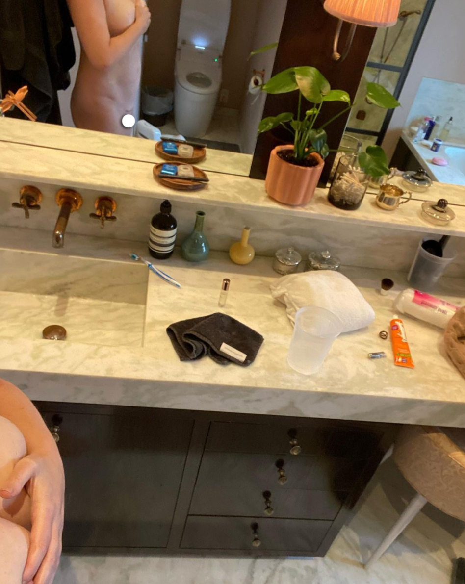 Amy Schumer Shares Naked Pic Of 'Cute' C-Section