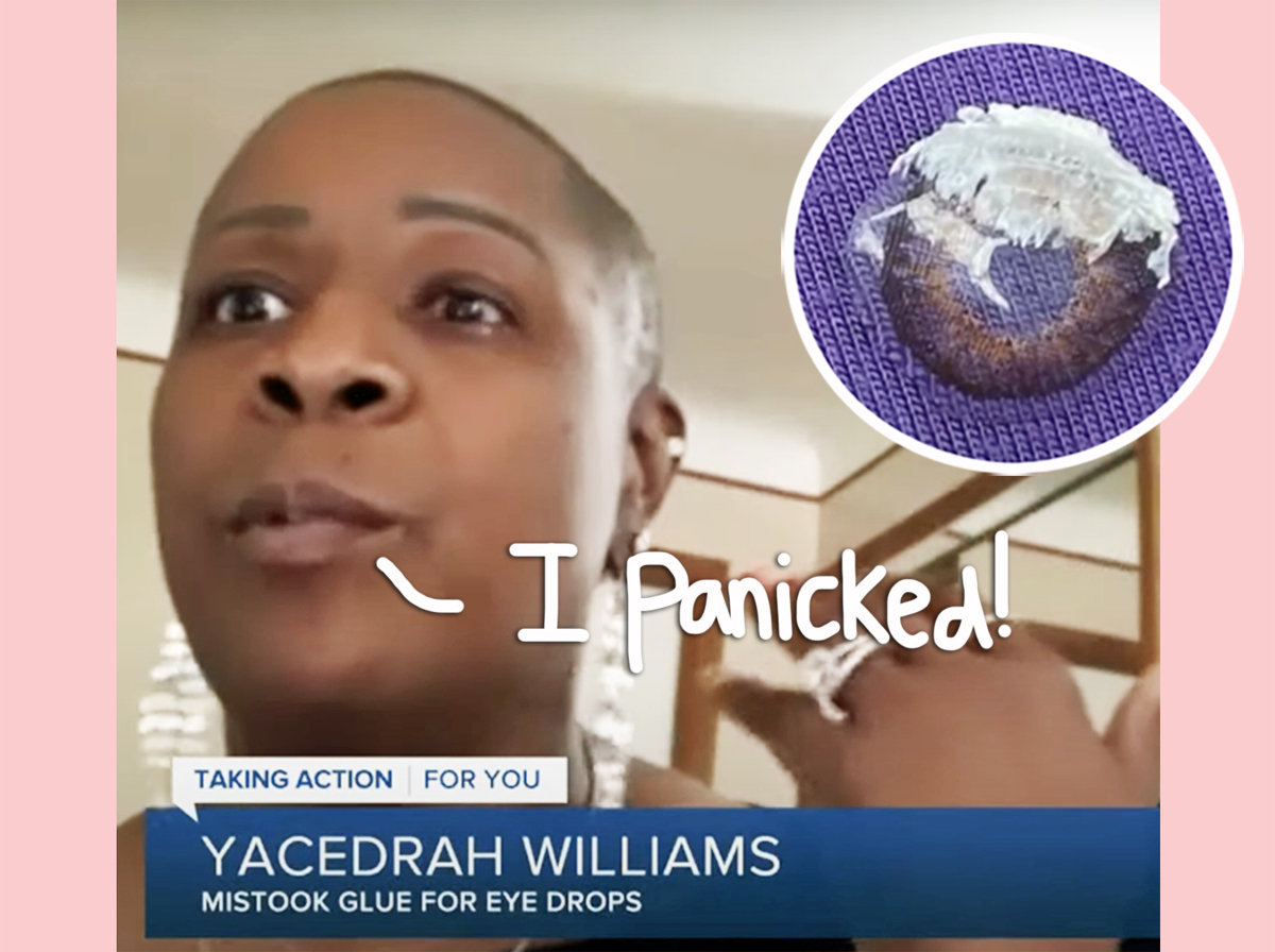 Woman Accidentally Glues Eye SHUT After Mistaking Nail Glue For Contact Drops! Hear Her Shocking