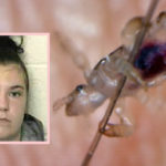Woman Charged After Her Daughter Nearly DIED From Severe Lice Infestation