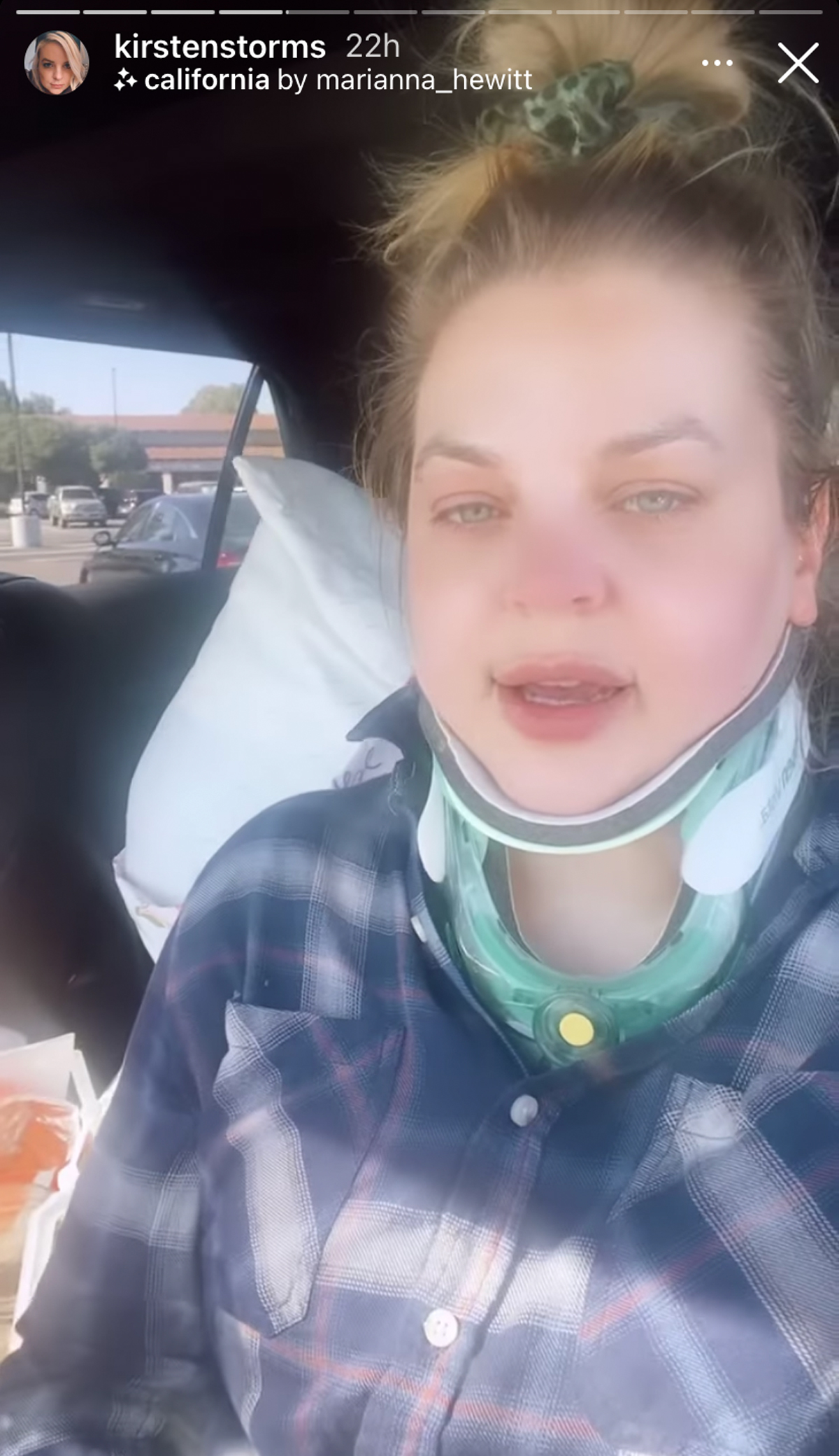 <i> Zenon: Girl of the 21st Century</i> & <i>General Hospital</i> Star Kirsten Storms Reveals She Underwent Brain Surgery 