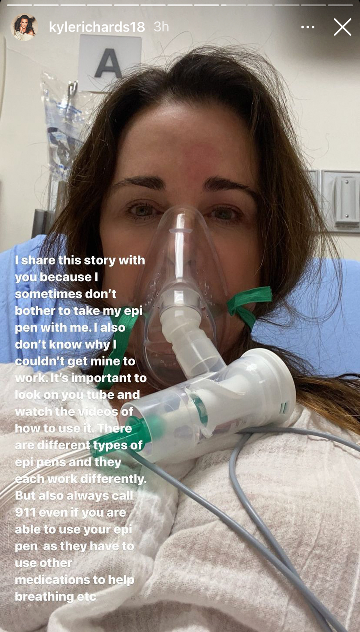 molto spaventoso!  La star di RHOBH Kyle Richards è stata ricoverata in ospedale dopo essere entrata in un alveare!