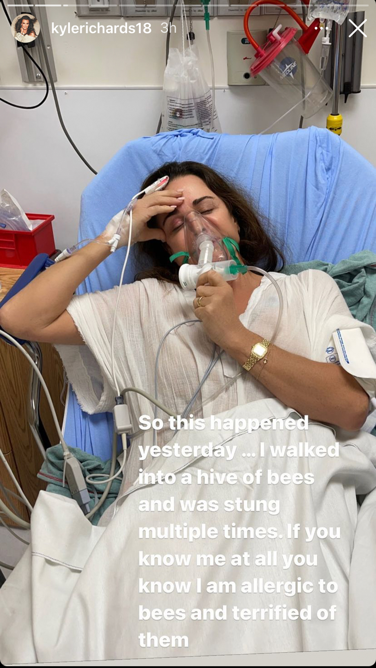 molto spaventoso!  La star di RHOBH Kyle Richards è stata ricoverata in ospedale dopo essere entrata accidentalmente in un alveare!