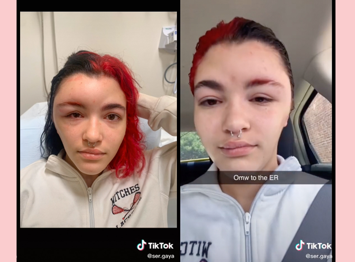 Teen's HORRIFYING Reaction To Hair Dye Goes Viral On TikTok - Perez Hilton
