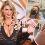 Brandi Glanville Hospitalized With Horrifying Mystery Infection After Being Warned She 'Could Lose A Limb'!