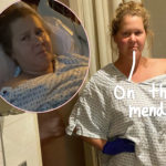 Amy Schumer Reveals She Had Her Uterus & Appendix Removed Due To Endometriosis
