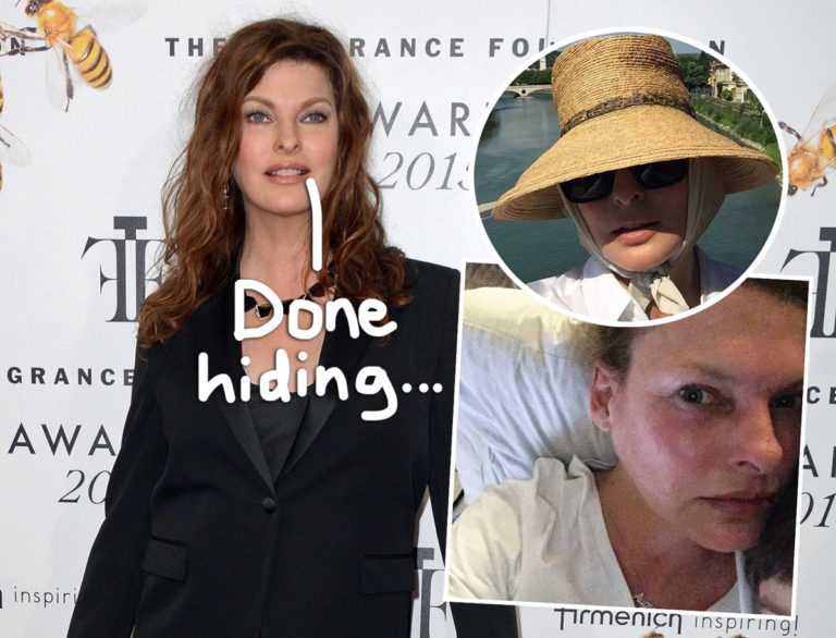 Iconic '90s Supermodel Linda Evangelista Reveals Cosmetic Procedure ...