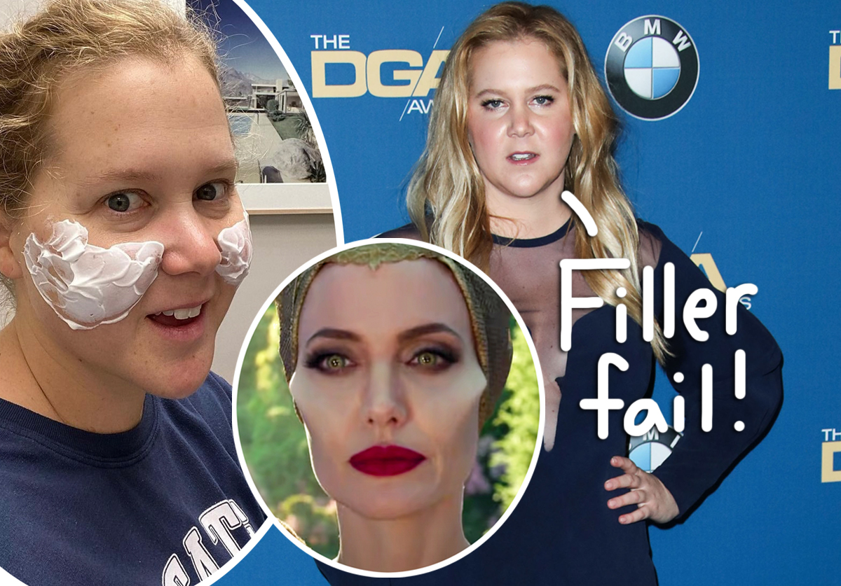 Amy Schumer Got Botched Plastic Surgery Immediately Undid It I Looked Like Maleficent