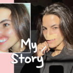 Model & Skateboarder Brooklinn Khoury Opens Up After Losing Lip In Horrific Dog Attack