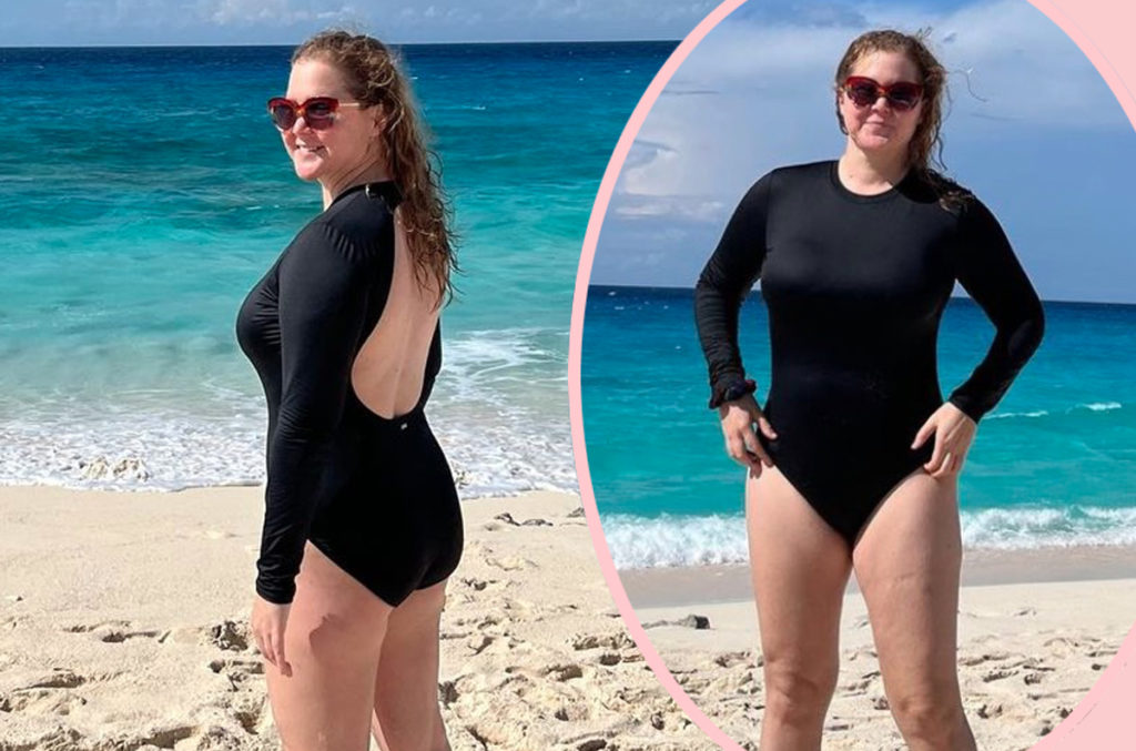 Amy Schumer Explains The Real Reason She Got Liposuction Hot Lifestyle News 