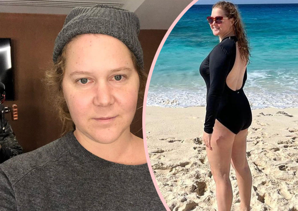 Amy Schumer Explains The Real Reason She Got Liposuction Perez Hilton 