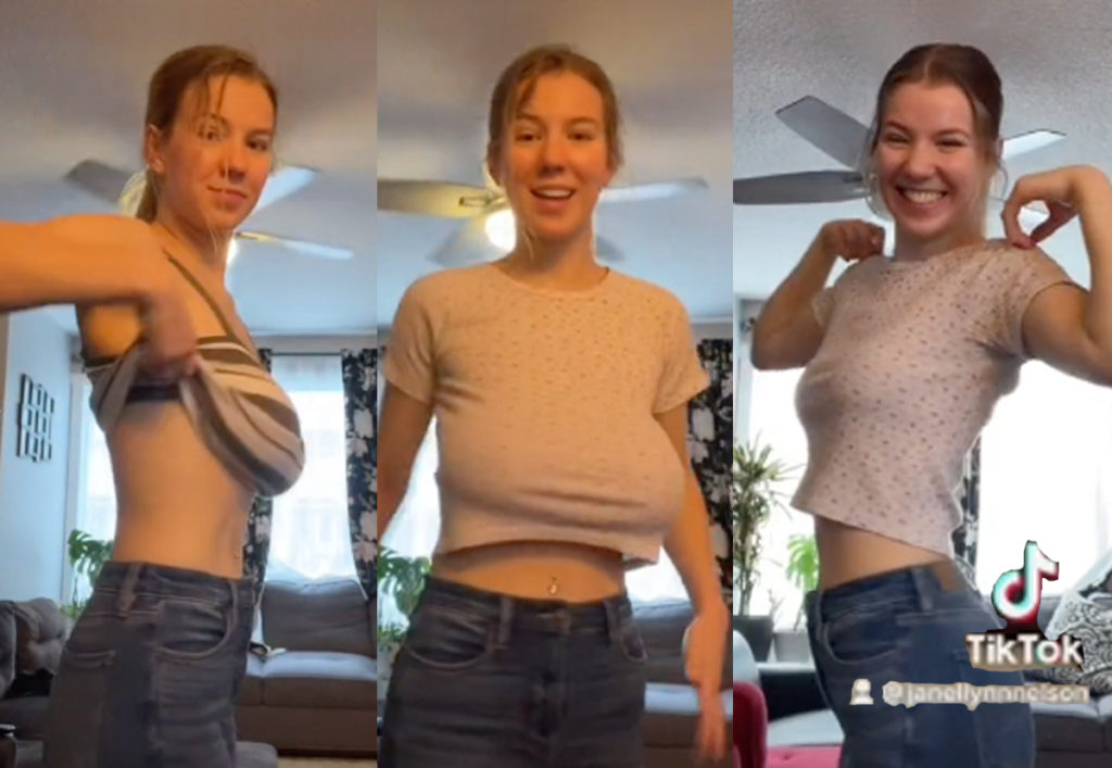 Doctors Refused This Woman A Breast Reduction 10 Times Despite Her