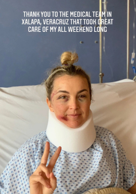 Liz Woodburn posts about her injuries