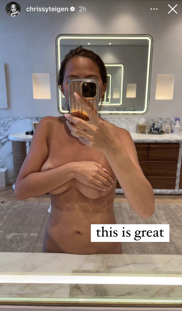 Chrissy Teigen Tan Lines Instagram Story