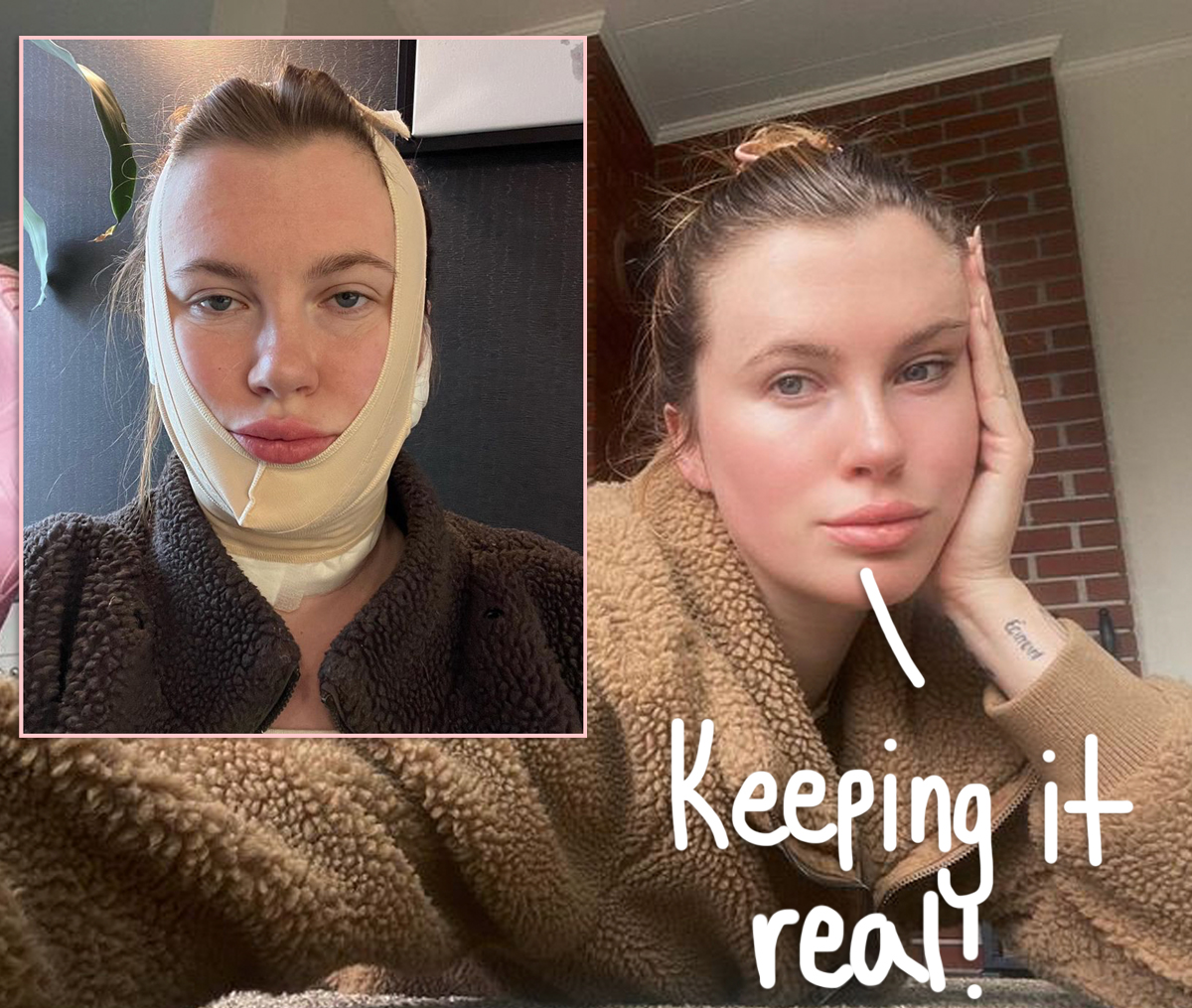 #Ireland Baldwin Opens Up About Decision To Get Plastic Surgery At 26!