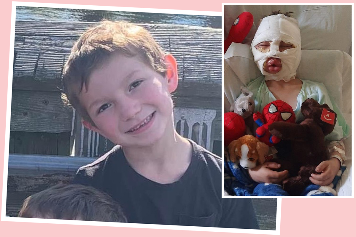 #6-Year-Old Boy Set On Fire & Nearly Killed, Allegedly By His 8-Year-Old Bully