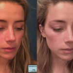 Did Amber Heard LIE About Photo Showing Alleged Johnny Depp Abuse?!