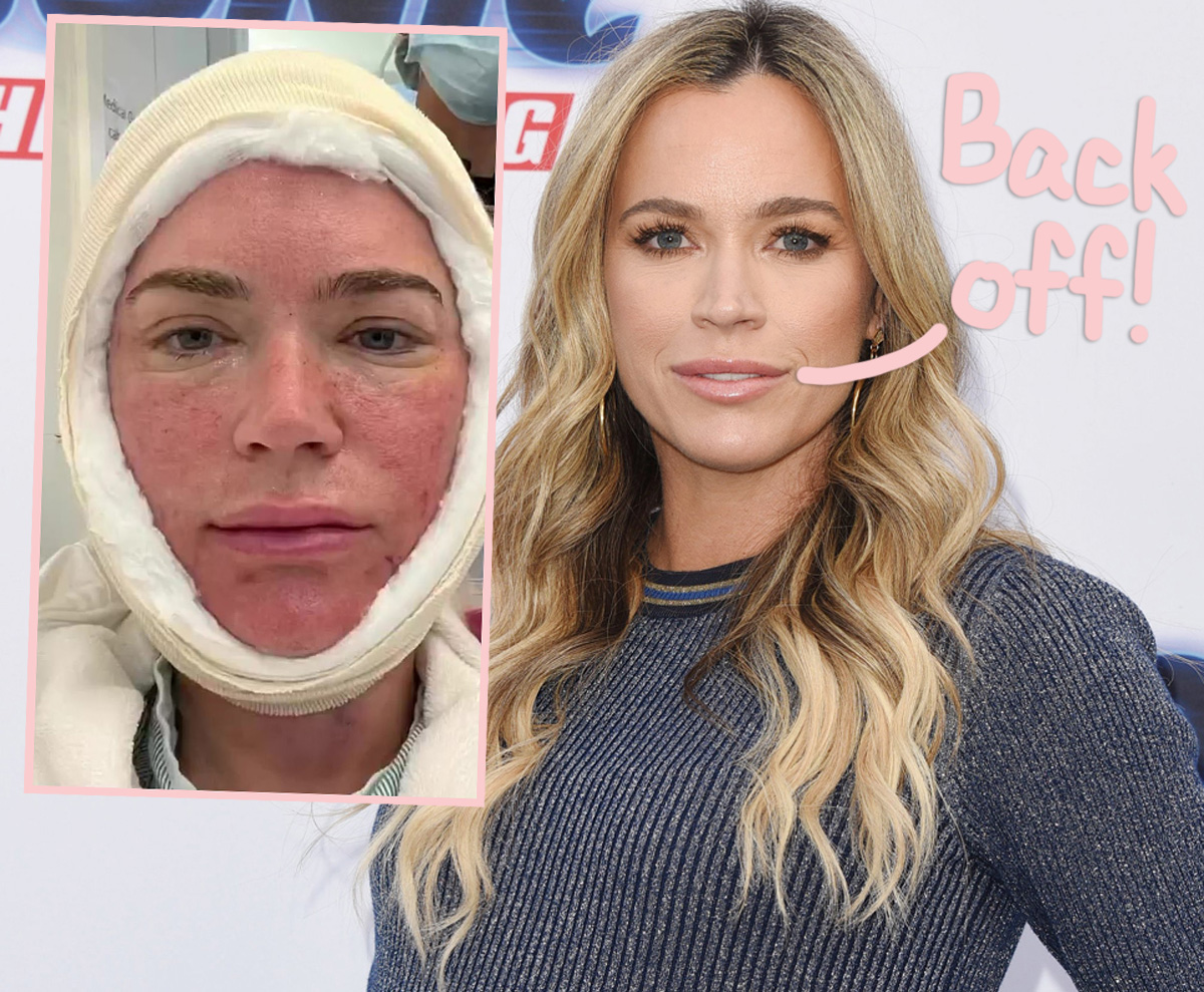 #Teddi Mellencamp Blasts Critics After Opening Up About Getting A Neck Lift!