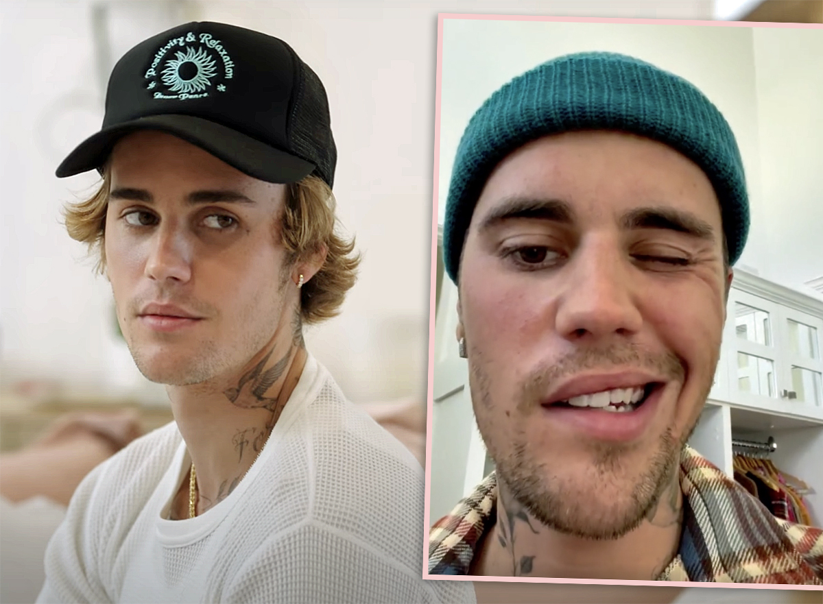 #Justin Bieber Gives Update On Scary Face Paralysis!