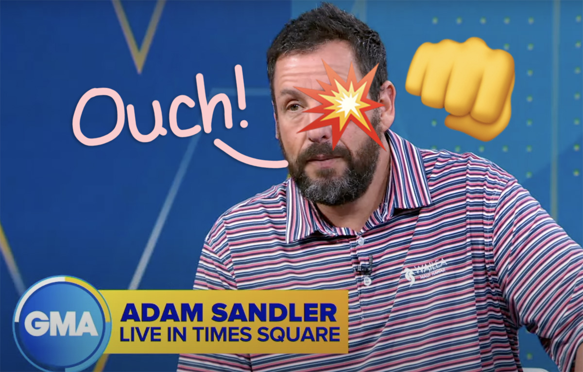 #The Weird Reason Adam Sandler Had A Black Eye On Live TV During GMA Interview!