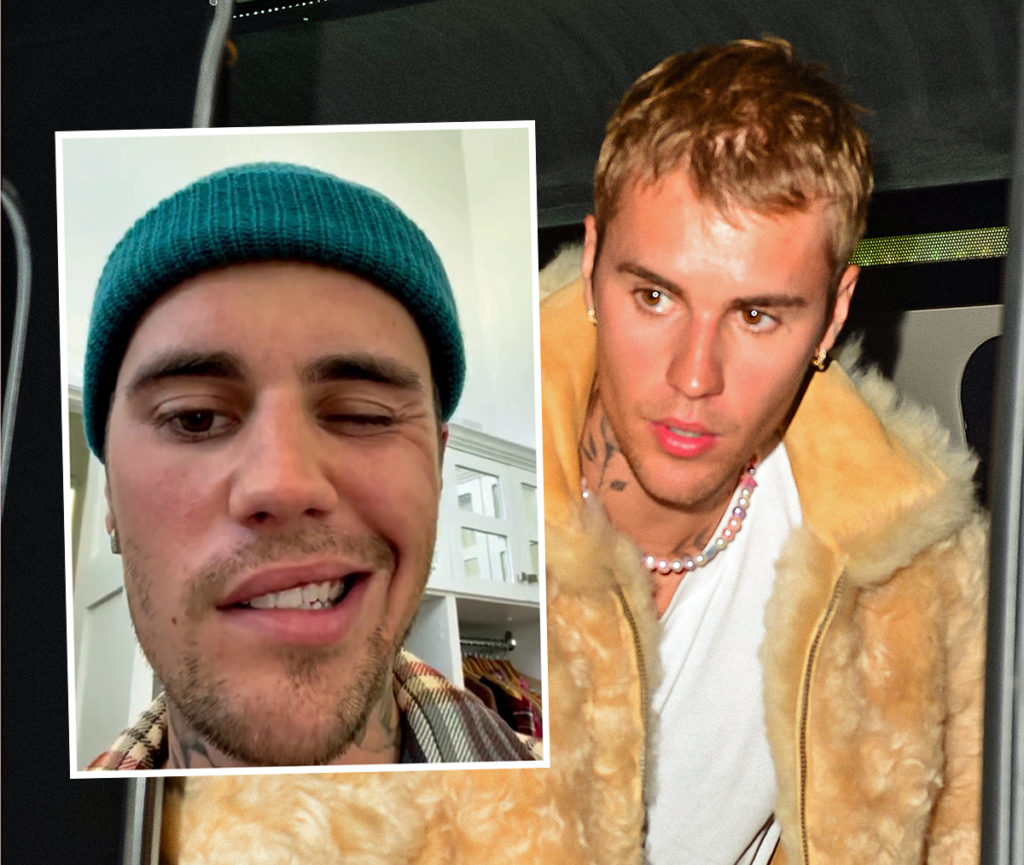 Justin Bieber reveals he's battling facial paralysis due to Ramsay Hunt  syndrome, puts brakes on tour, plus more news, Gallery