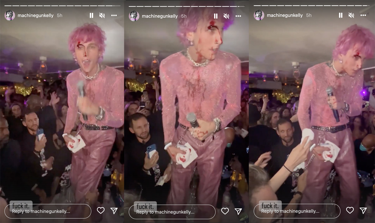 Machine Gun Kelly Shatters Glass Over His Head & Starts Bleeding Profusely At NYC Party! WTF?!