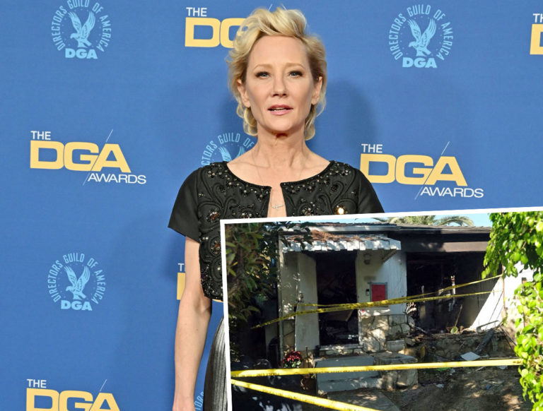 Anne Heche Dead At 53 After Fiery Car Crash - Perez Hilton