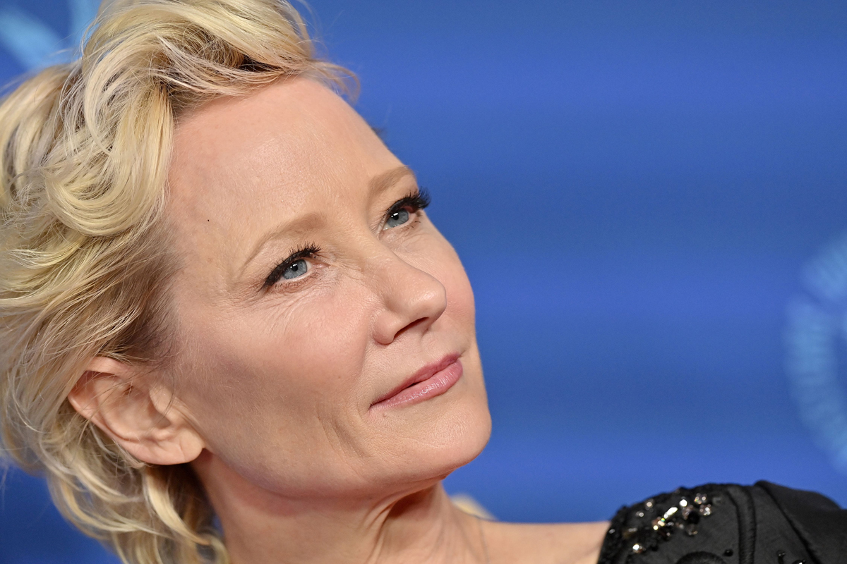 Anne Heche in Stable Condition, Hospitalized After Car Crash