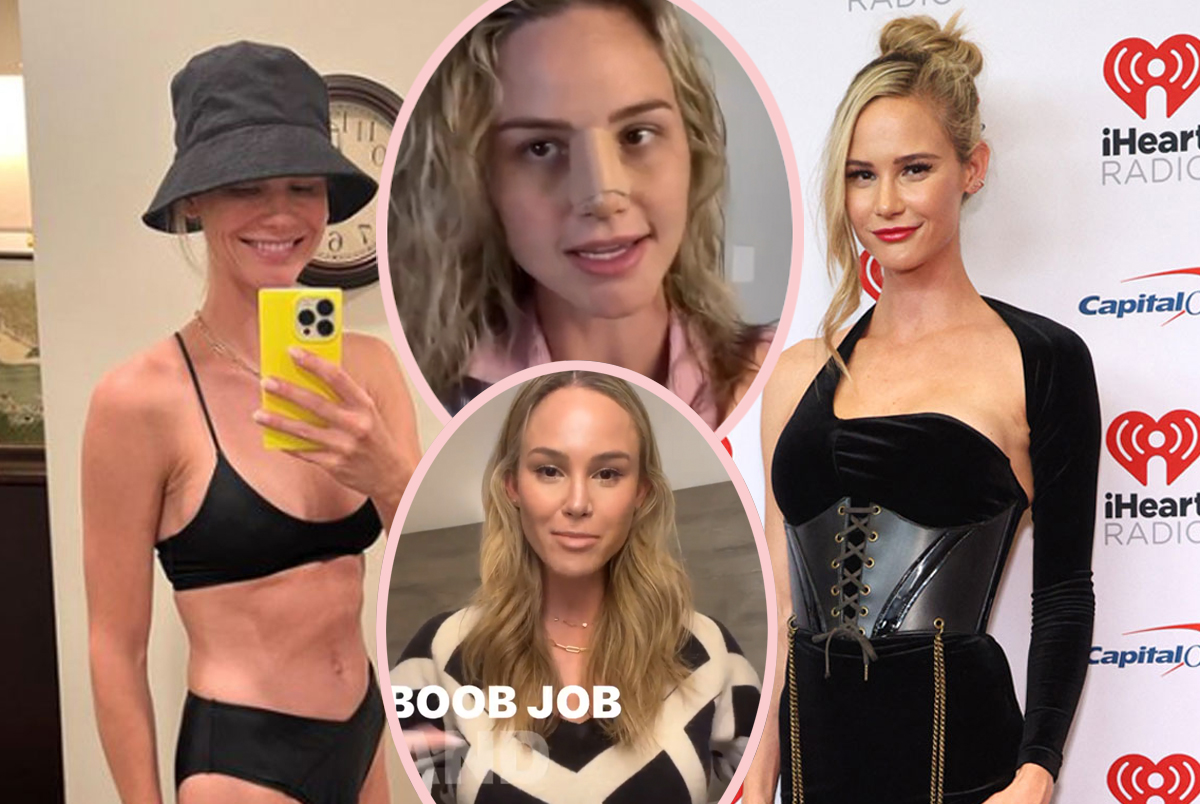 #Meghan King Got Her Boobs & Nose Done — And She’s Sharing All!