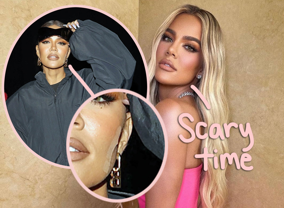 #Khloé Kardashian Details Getting A TUMOR Removed From Her Face!!