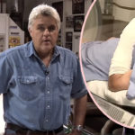Recovering Jay Leno Seen For First Time Since Suffering Horrible Burns