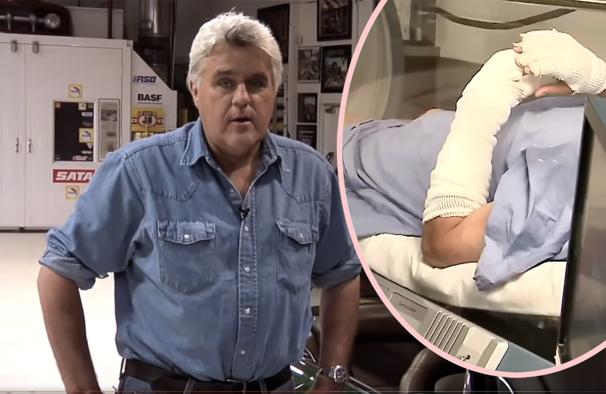 Recovering Jay Leno Seen For First Time Since Suffering Horrible Burns Perez Hilton