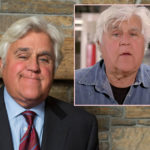 Jay Leno May Need Skin Grafts After Car Fire That Left Him Badly Burned